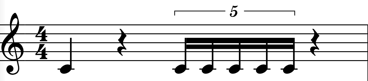 Quater Note Quintuplet