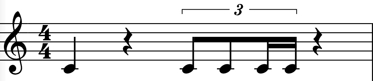 Quater Note Triplet Score 1